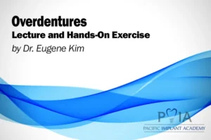Overdentures
